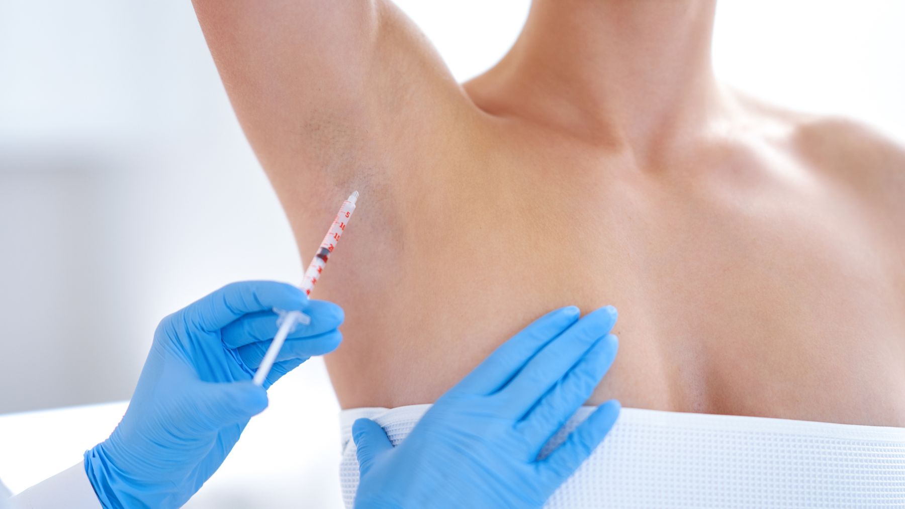 Leczenie nadpotliwości Warszawa