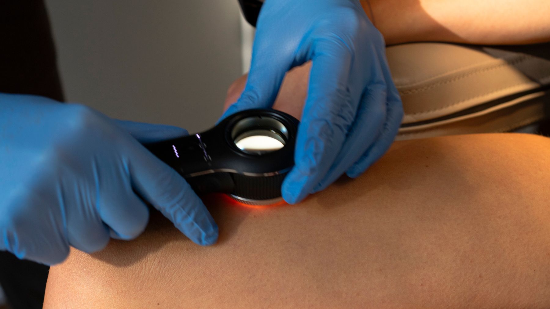 konsultacja dermatologiczna warszawa